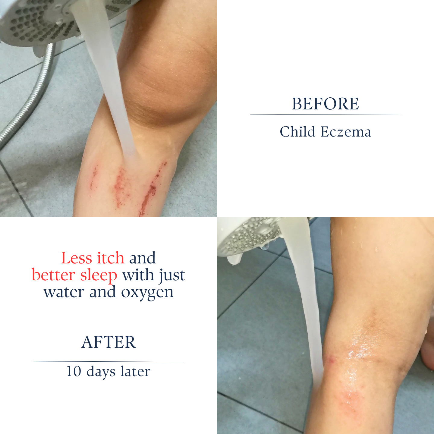 aerbubblr Microbubble Showerhead